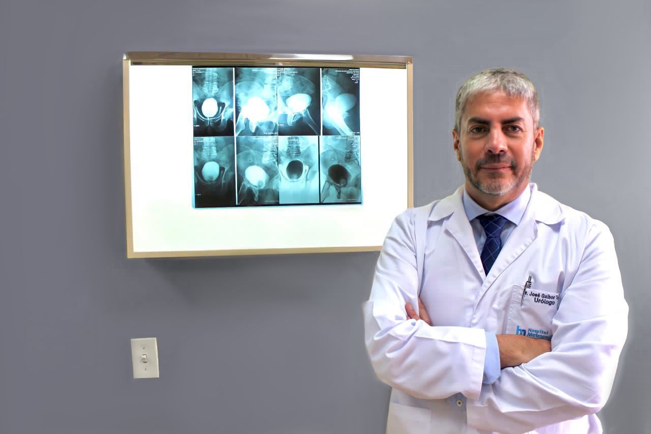 Equipos de última generación en urología